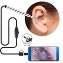 Otoscope optique electronique