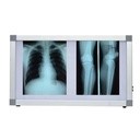 Négatoscope deux places